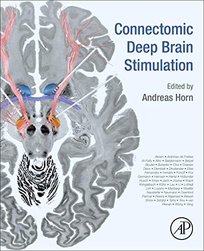 Book Connectomic Deep Brain Stimulation free
