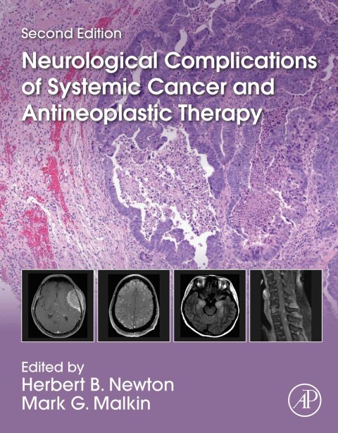 Book Neurological Complications of Systemic Cancer and Antineoplastic Therapy free