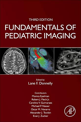 Book Fundamentals of Pediatric Imaging free