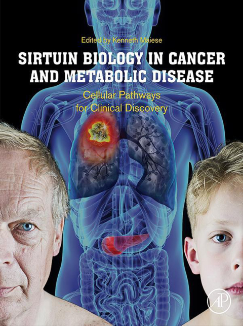 Book Sirtuin Biology in Cancer and Metabolic Disease free