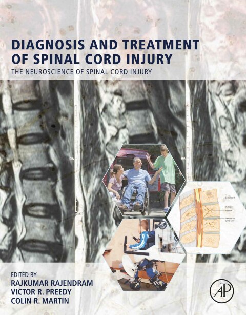 Book Diagnosis and Treatment of Spinal Cord Injury free