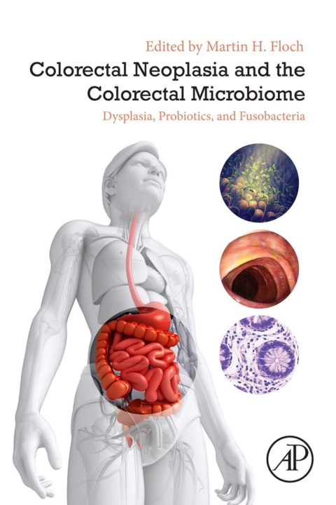 Book Colorectal Neoplasia and the Colorectal Microbiome free