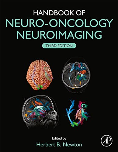 Book Handbook of Neuro-Oncology Neuroimaging free