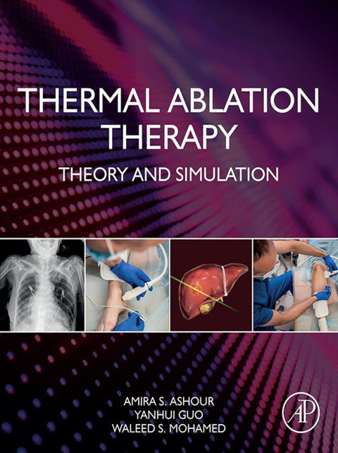 Book Thermal Ablation Therapy free