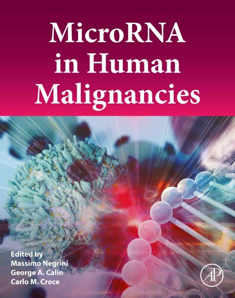 Book MicroRNA in Human Malignancies free