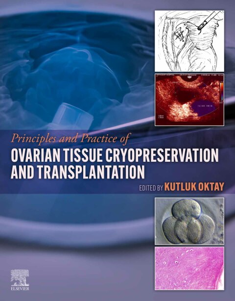 Book Principles and Practice of Ovarian Tissue Cryopreservation and Transplantation free