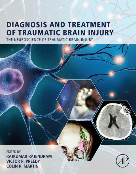 Book Diagnosis and Treatment of Traumatic Brain Injury free