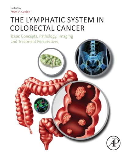 Book The Lymphatic System in Colorectal Cancer: Basic Concepts, Pathology, Imaging, and Treatment Perspectives free