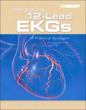 Book Understanding 12-Lead EKGs: A Practical Approach (2nd Edition) free