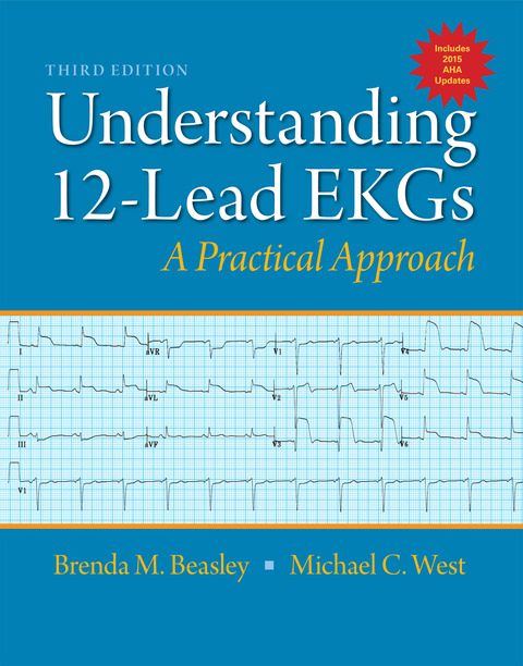 Book Understanding 12-Lead EKGs free