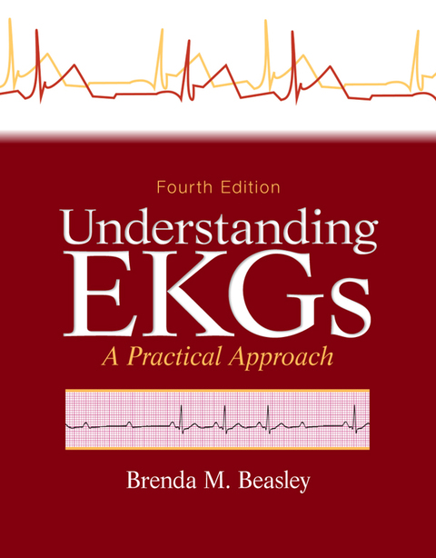 Book Understanding EKGs free
