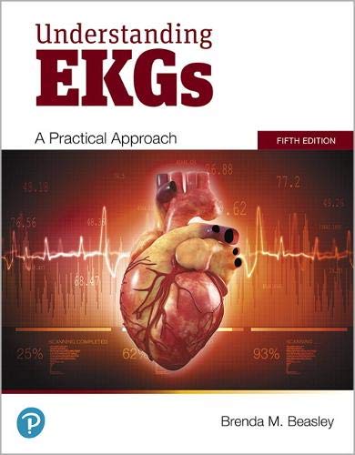 Book Understanding EKGs: A Practical Approach free
