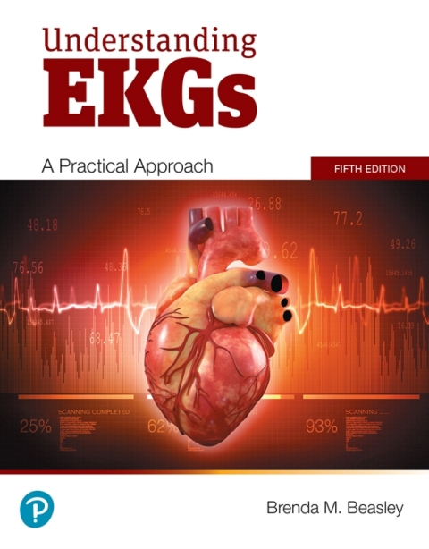 Book Understanding EKGs free
