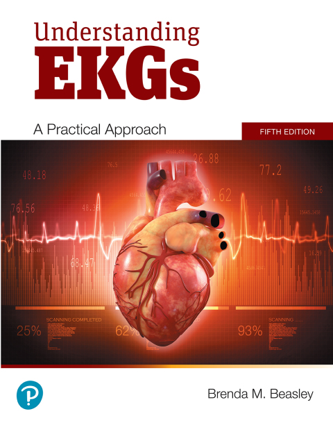 Book Understanding EKGs free