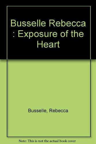 Book Exposure of the Heart free