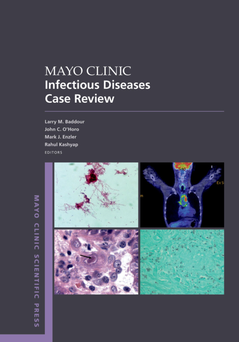 Book Mayo Clinic Infectious Disease Case Review: With Board-Style Questions and Answers (Mayo Clinic Scientific Press) free