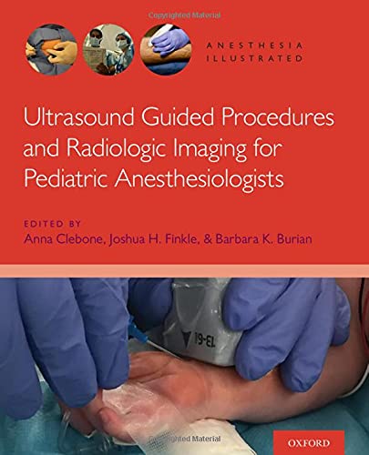 Book Ultrasound Guided Procedures and Radiologic Imaging for Pediatric Anesthesiologists (Anesthesia Illustrated) free