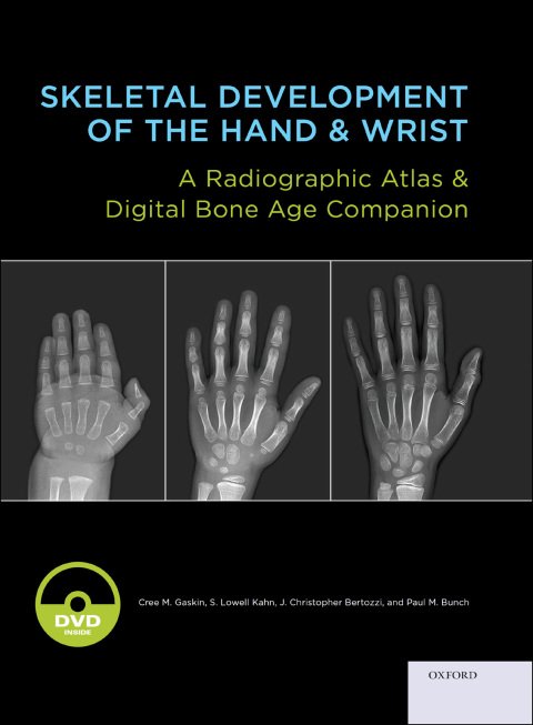 Book Skeletal Development of the Hand and Wrist: A Radiographic Atlas and Digital Bone Age Companion free