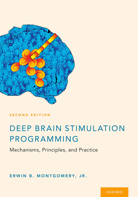 Book Deep Brain Stimulation Programming free