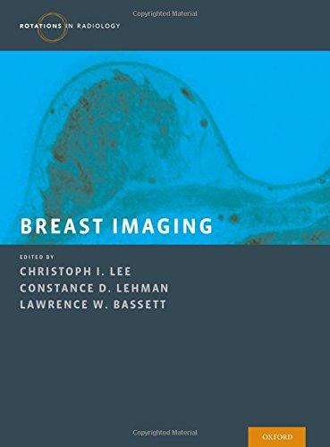 Book Breast Imaging (Rotations in Radiology) free