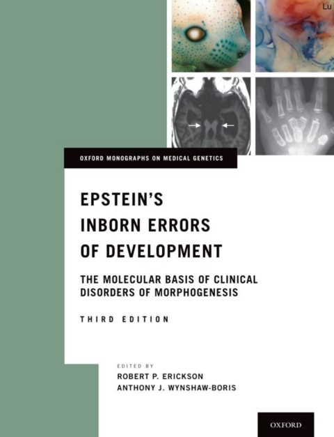Book Epstein's Inborn Errors of Development free