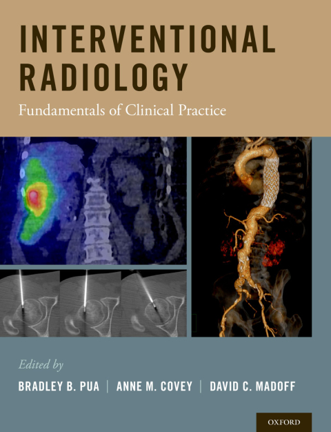 Book Interventional Radiology: Fundamentals of Clinical Practice free