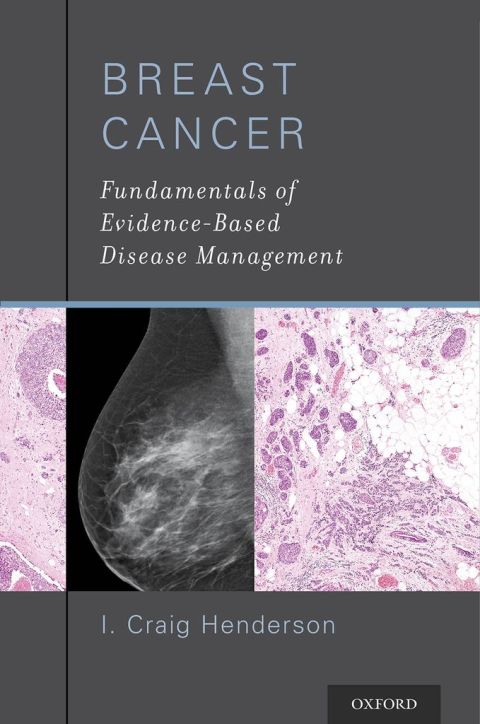 Book Breast Cancer: Fundamentals of Evidence-Based Disease Management free