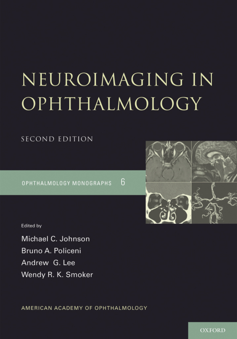 Book Neuroimaging in Ophthalmology (American Academy of Ophthalmology Monograph Series Book 6) free