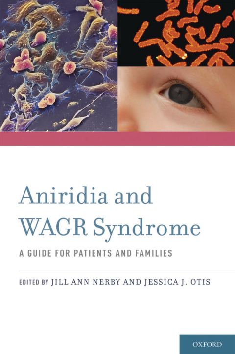 Book Aniridia and WAGR Syndrome: A Guide for Patients and Their Families free