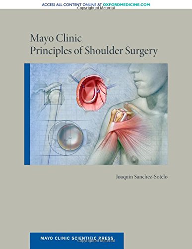 Book Mayo Clinic Principles of Shoulder Surgery (Mayo Clinic Scientific Press) free