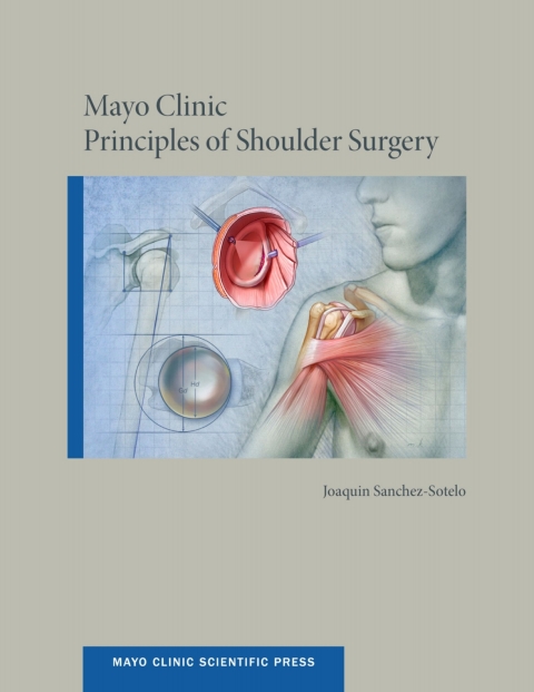 Book Mayo Clinic Principles of Shoulder Surgery free