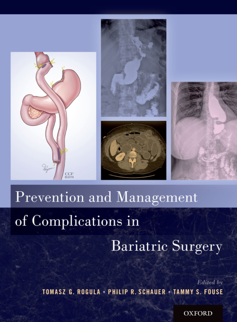 Book Prevention and Management of Complications in Bariatric Surgery free