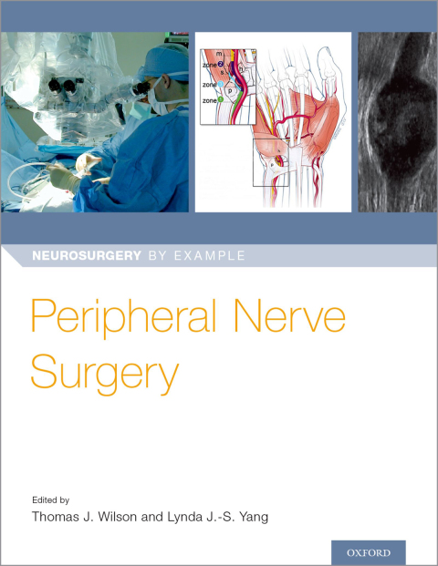 Book Peripheral Nerve Surgery free