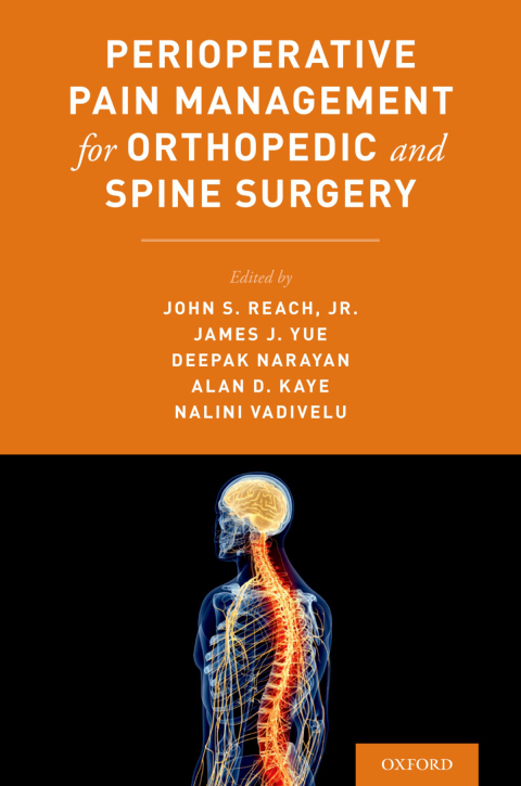 Book Perioperative Pain Management for Orthopedic and Spine Surgery free