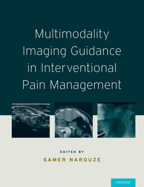Book Multimodality Imaging Guidance in Interventional Pain Management free