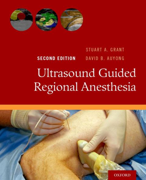 Book Ultrasound Guided Regional Anesthesia free