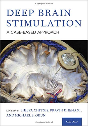Book Deep Brain Stimulation: A Case-based Approach free