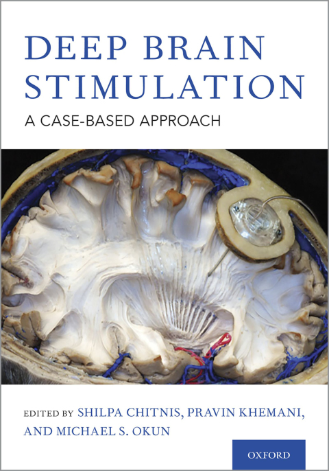 Book Deep Brain Stimulation free