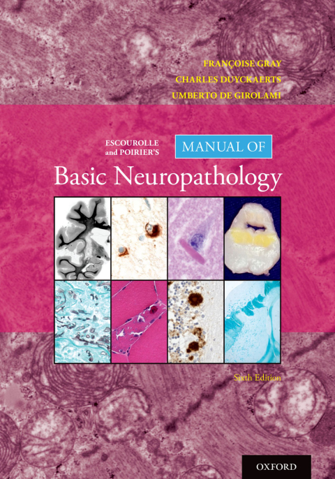 Book Escourolle and Poirier's Manual of Basic Neuropathology free