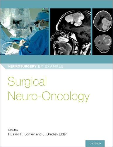 Book Surgical Neuro-Oncology (Neurosurgery by Example) free