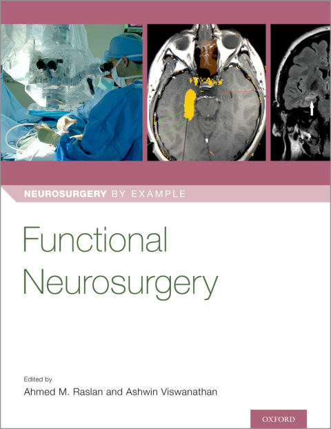 Book Functional Neurosurgery free