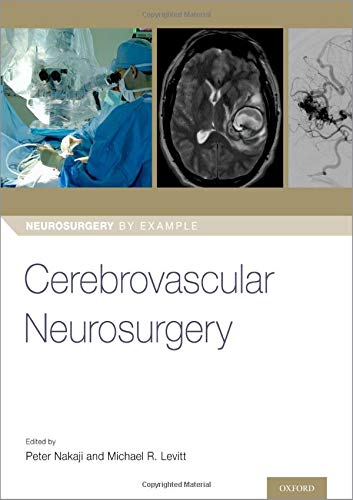 Book Cerebrovascular Neurosurgery (Neurosurgery by Example) free