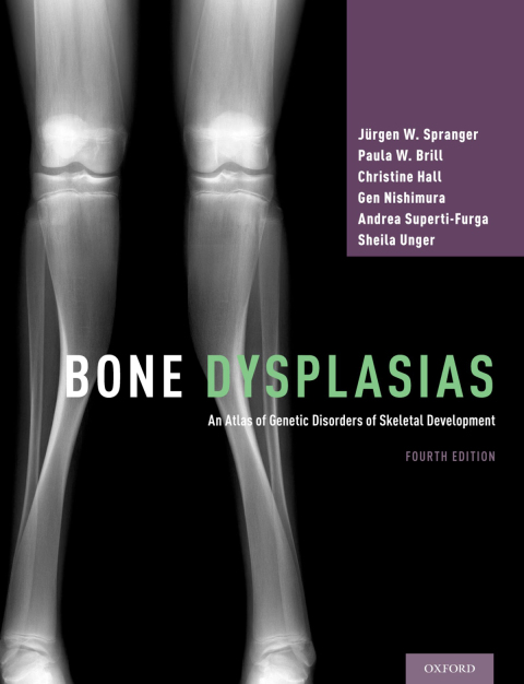 Book Bone Dysplasias free