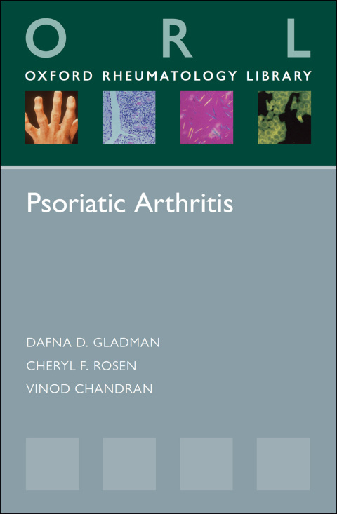 Book Psoriatic Arthritis free