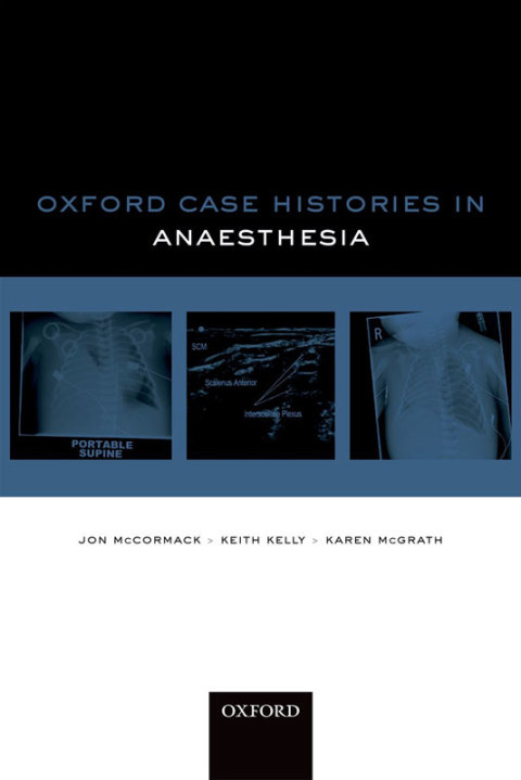 Book Oxford Case Histories in Anaesthesia free