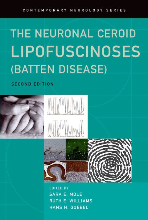 Book The Neuronal Ceroid Lipofuscinoses (Batten Disease) (Contemporary Neurology Series Book 78) free