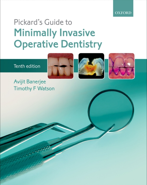 Book Pickard's Guide to Minimally Invasive Operative Dentistry free