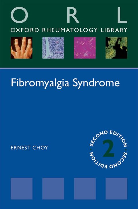 Book Fibromyalgia Syndrome (Oxford Rheumatology Library) free