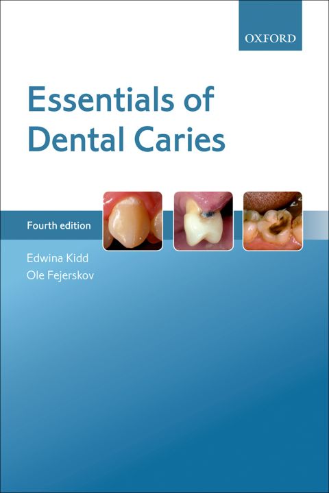 Book Essentials of Dental Caries free