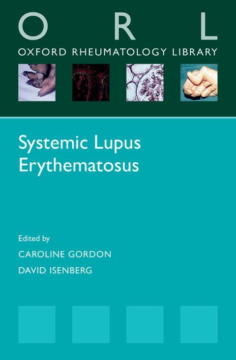 Book Systemic Lupus Erythematosus free